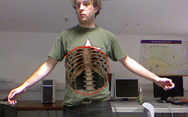 kinect-xray