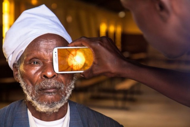 peek-smartphone-eye-exam