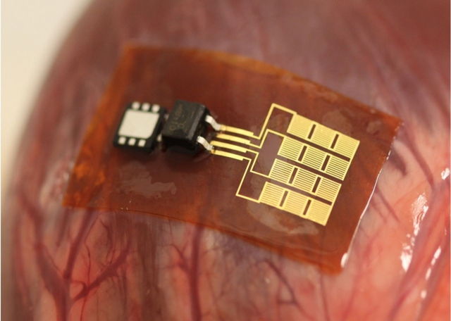 piezoelectric-organ-power
